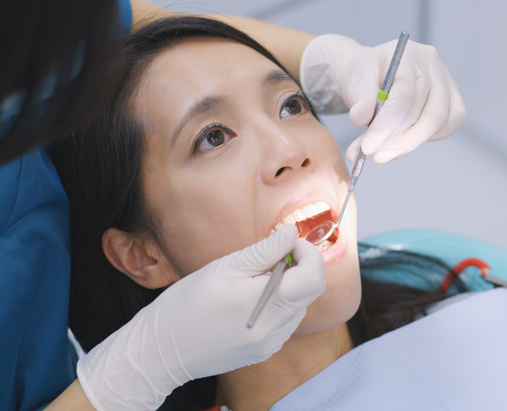 虫歯・歯周病を予防